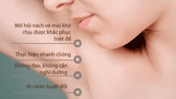 BOTOX GIẢM TIẾT MỒ HÔI NÁCH “CHÌA KHÓA” THÔNG MINH CHO VÙNG DA KHÔ THOÁNG