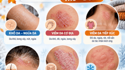 BỆNH DA THƯỜNG GẶP KHI GIAO MÙA THU – ĐÔNG